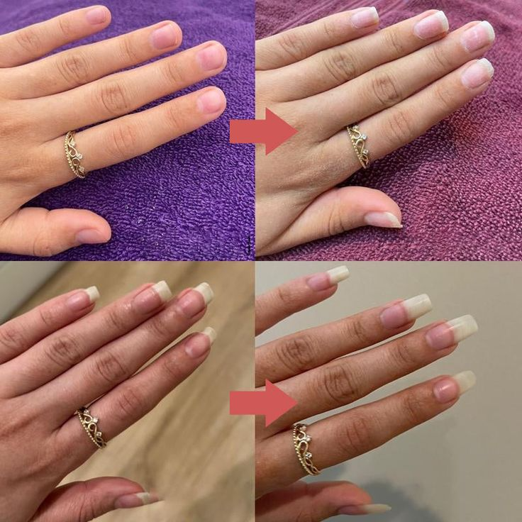 NAIL GROWTH SERUM[5x large]