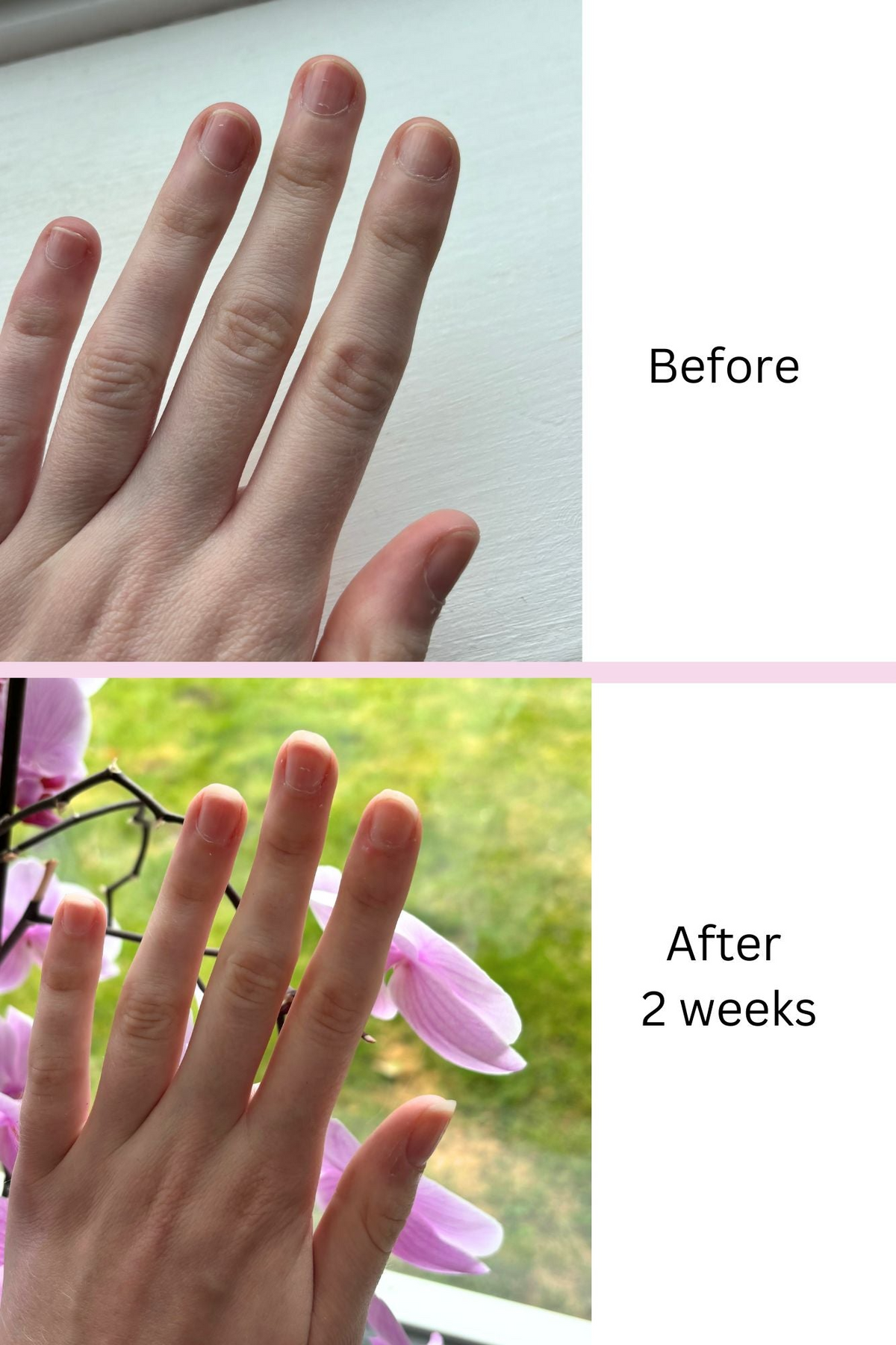 NAIL GROWTH SERUM[5x large]