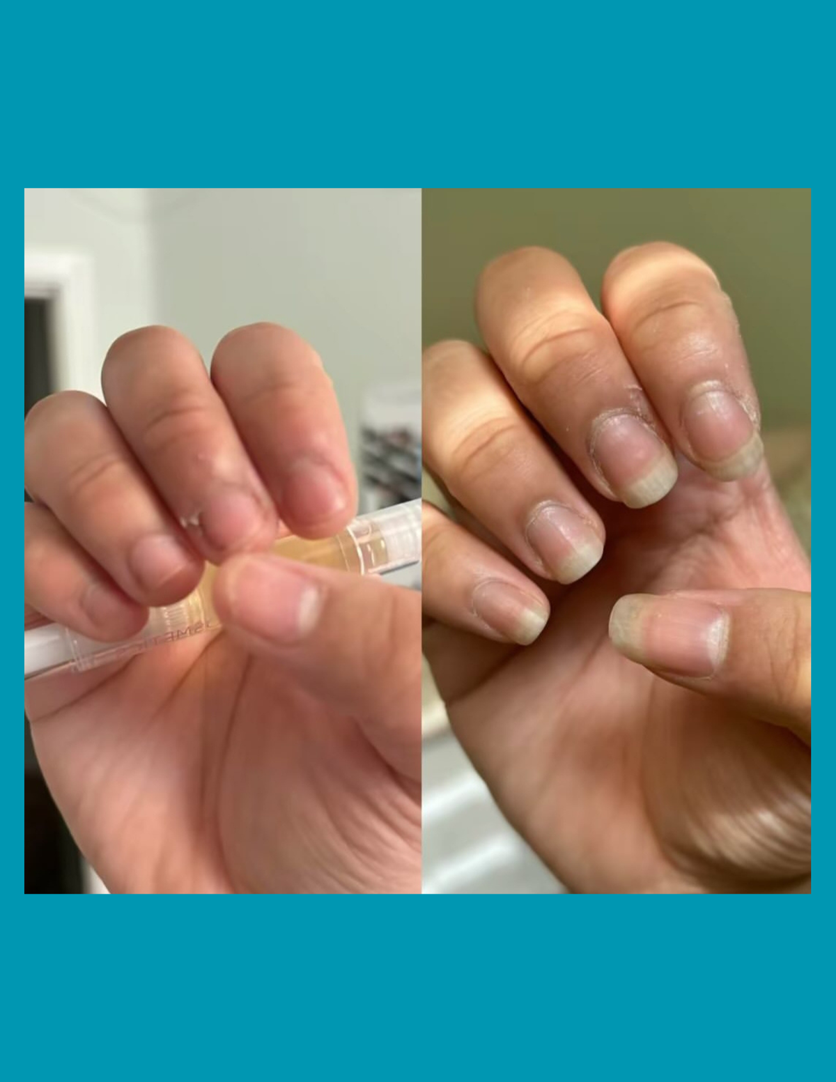 NAIL GROWTH SERUM[5x large]