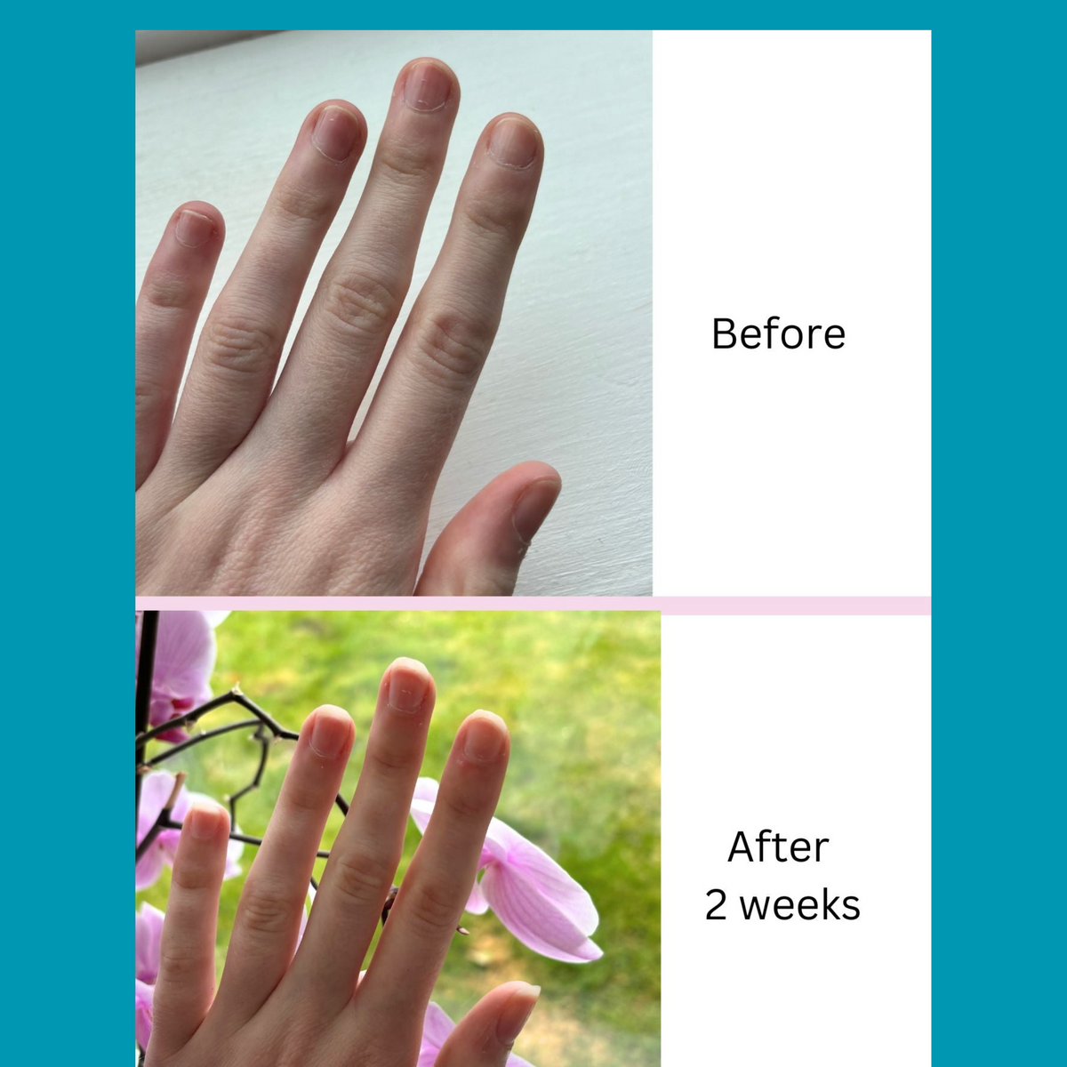 NAIL GROWTH OIL